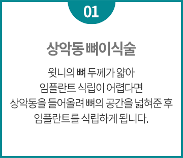 원장님 직접 시술