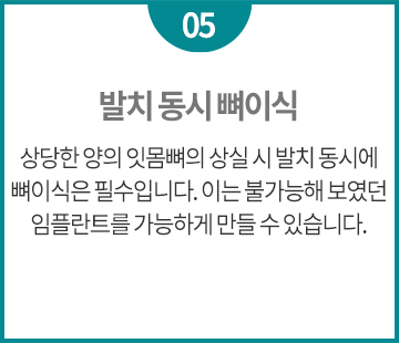 치료 보증